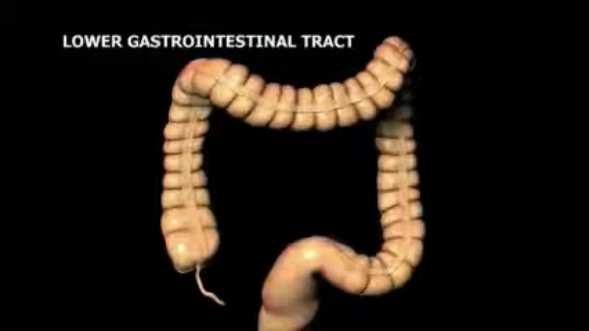 Why Colonoscopy Screenshot