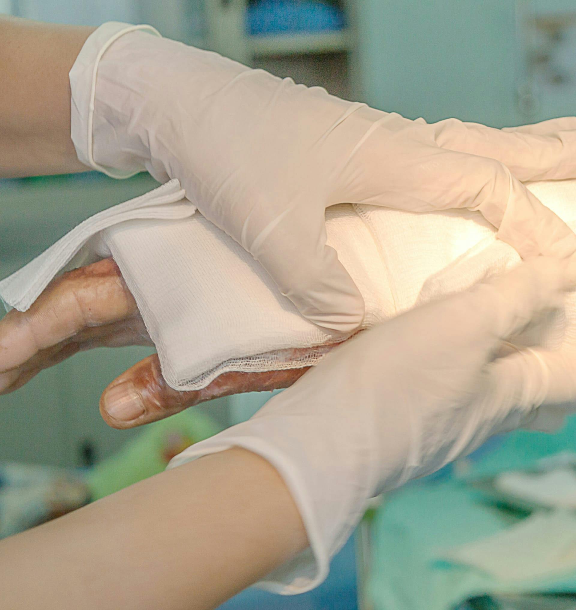 doctor treating a burn victim