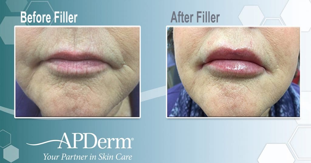 restoration and enhancement