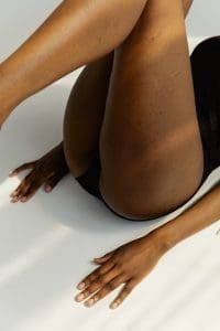 Spider veins