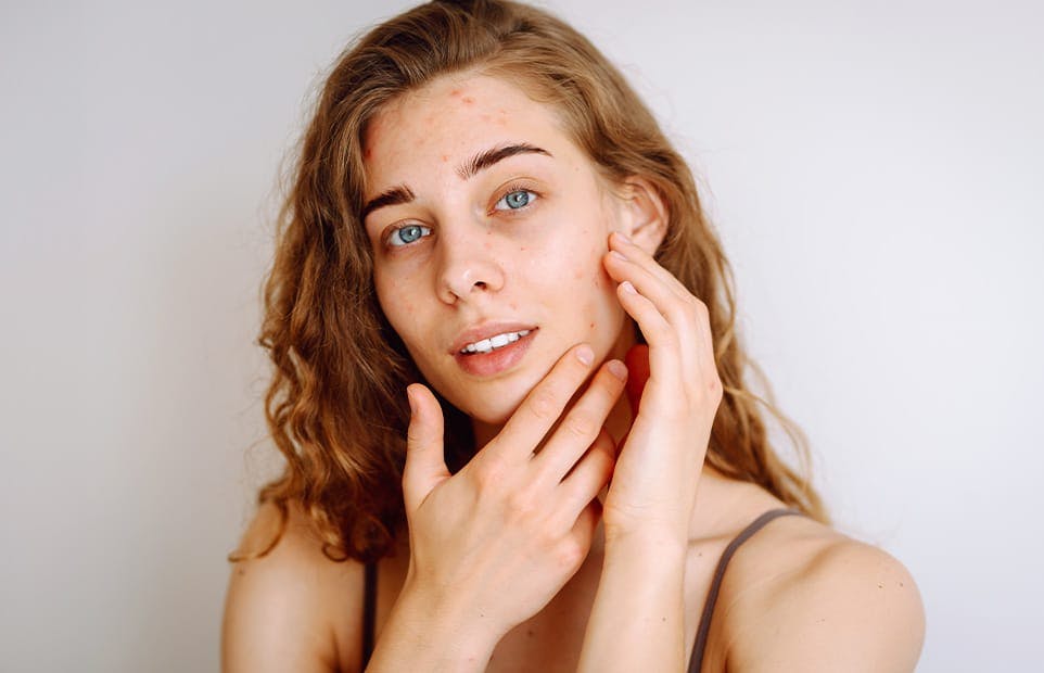 Woman holding her cheek