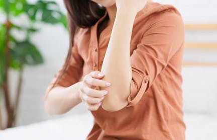 Woman scratching her elbow
