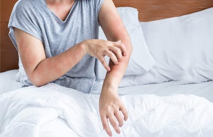 Woman scratching her forearm