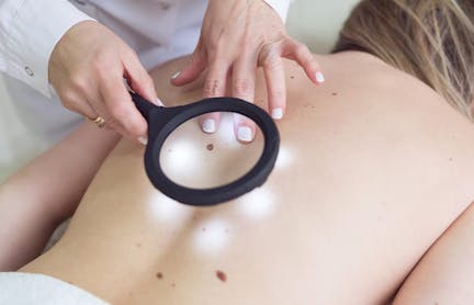 Woman having mole examined