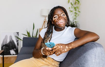 Woman with vitiligo holding smartphone