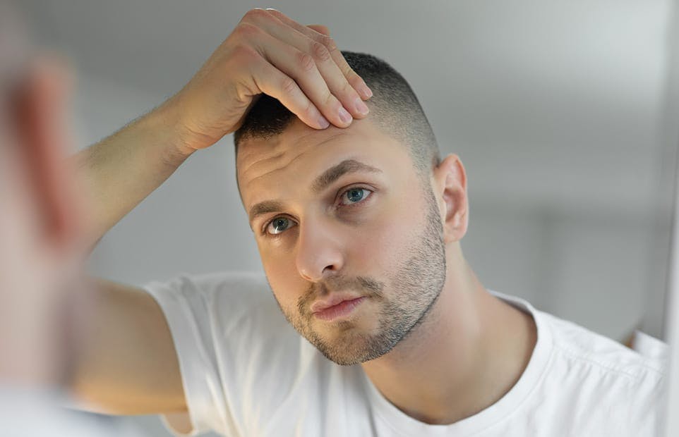 male hair transplant patient inspect hairline in mirror