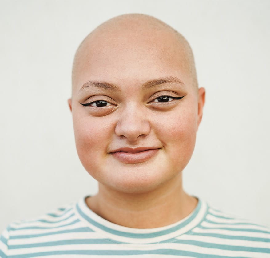 Symptoms and Treatments of Alopecia and Hair Loss | APDerm