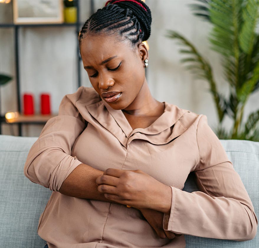 Woman scratching her arm