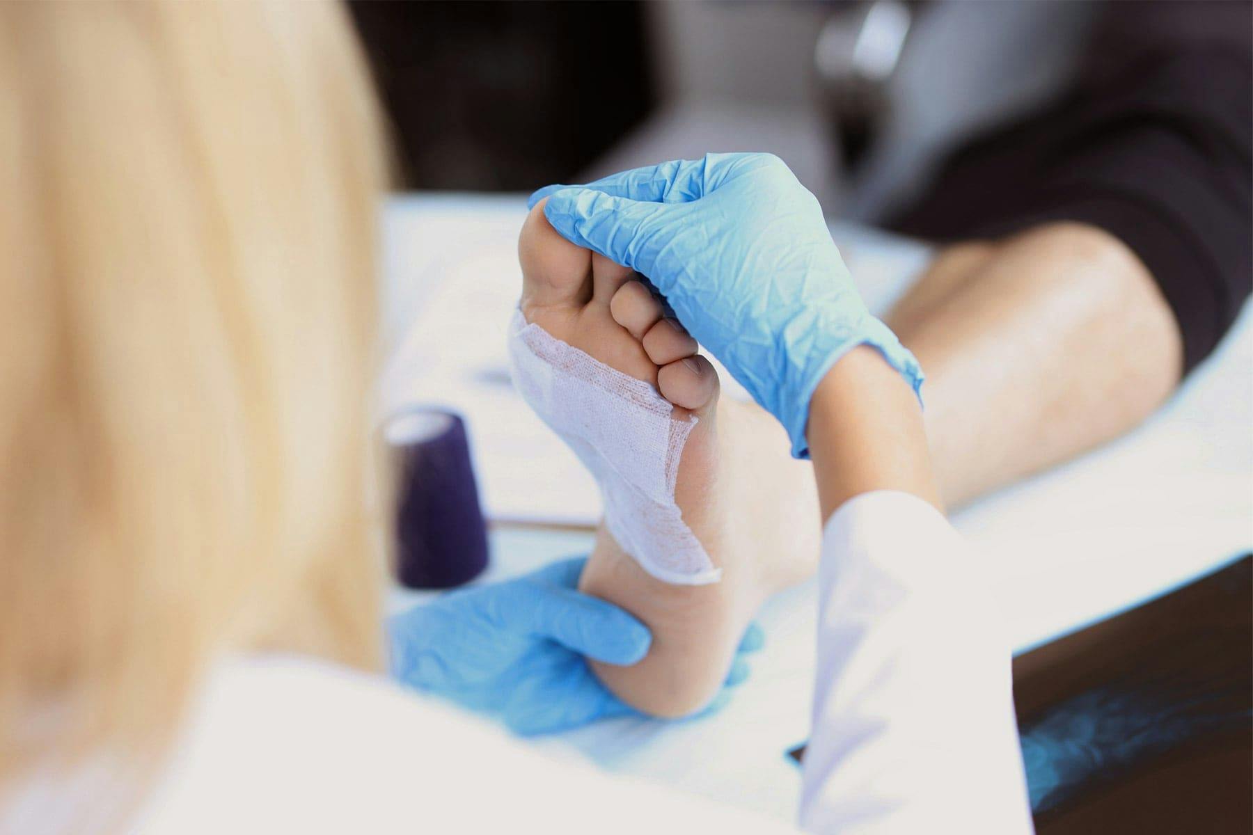 Planter Warts - Everything You Need To Know | APDerm