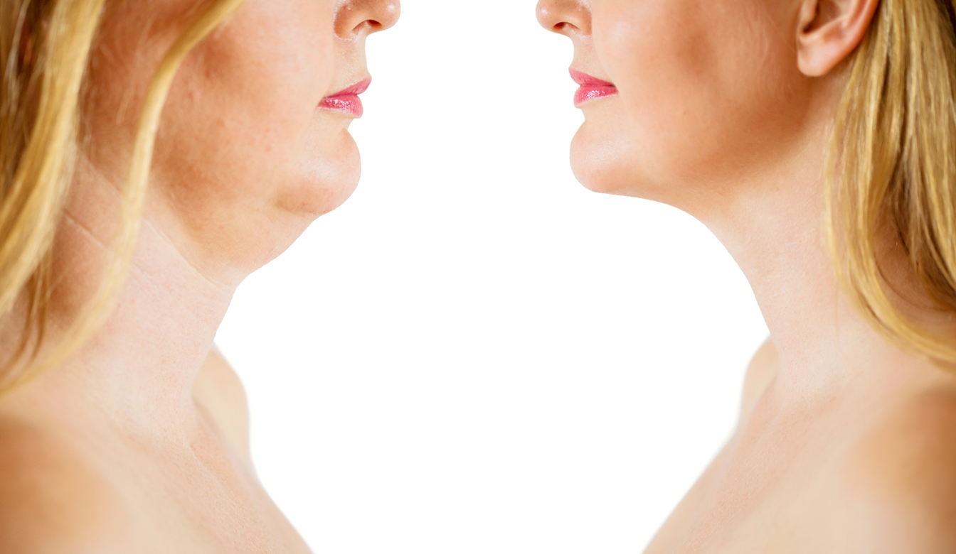 how much semaglutide to start ᐅ What is the recommended semaglutide dose? • HealthExpress®