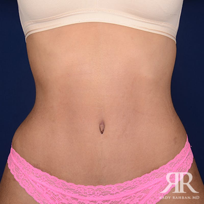 Before and after patient results