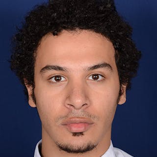 Ethnic Rhinoplasty Before & After Gallery - Patient 105552 - Image 2