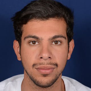 Male Rhinoplasty Before & After Gallery - Patient 873958 - Image 2