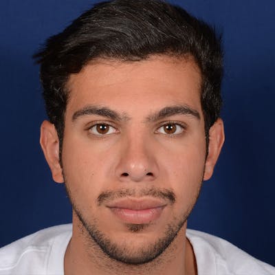 Male Rhinoplasty Before & After Gallery - Patient 873958 - Image 2