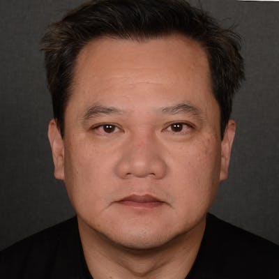 Chin Augmentation Before & After Gallery - Patient 279809 - Image 1