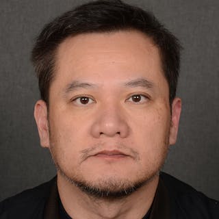 Chin Augmentation Before & After Gallery - Patient 279809 - Image 2