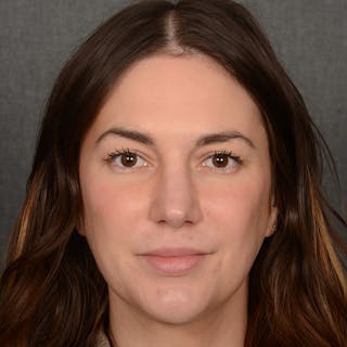 Female Rhinoplasty Before & After Gallery - Patient 259908 - Image 2