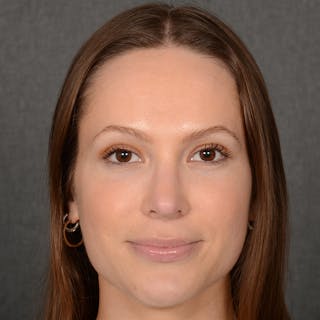 Female Rhinoplasty Before & After Gallery - Patient 356526 - Image 2