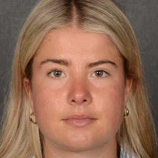 Female Rhinoplasty Before & After Gallery - Patient 518258 - Image 2