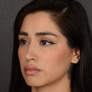Female Rhinoplasty Before & After Gallery - Patient 303772 - Image 4