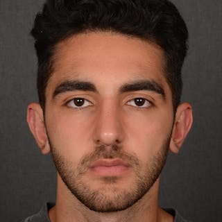 Male Rhinoplasty Before & After Gallery - Patient 294002 - Image 2