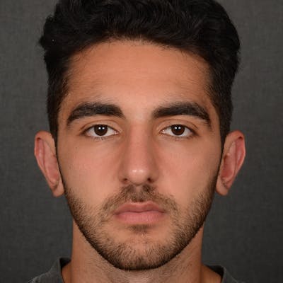 Male Rhinoplasty Before & After Gallery - Patient 294002 - Image 2
