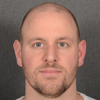 Male Rhinoplasty Before & After Gallery - Patient 594551 - Image 2