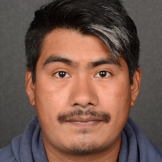 Male Rhinoplasty Before & After Gallery - Patient 393961 - Image 2