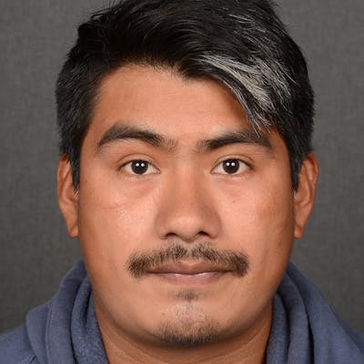 Male Rhinoplasty Before & After Gallery - Patient 393961 - Image 2