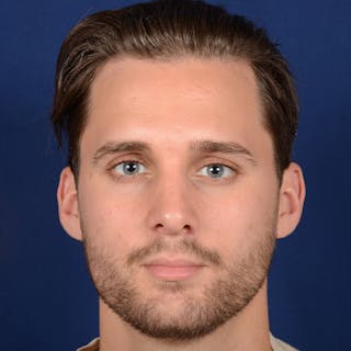Male Rhinoplasty Before & After Gallery - Patient 915882 - Image 2