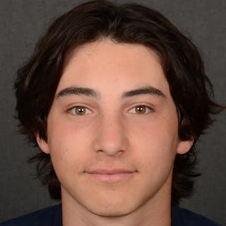 Male Rhinoplasty Before & After Gallery - Patient 105256 - Image 2