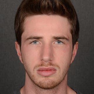 Male Rhinoplasty Before & After Gallery - Patient 165904 - Image 2