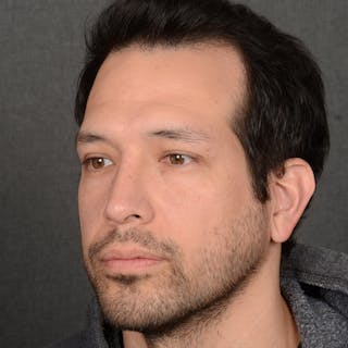 Male Rhinoplasty Before & After Gallery - Patient 205221 - Image 4