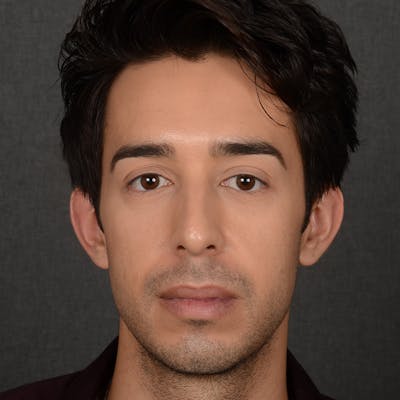 Male Rhinoplasty Before & After Gallery - Patient 405011 - Image 1