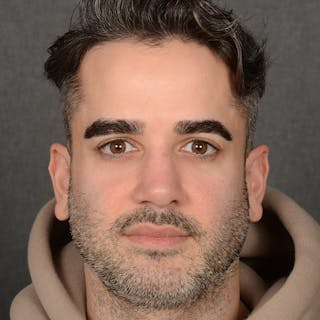 Male Rhinoplasty Before & After Gallery - Patient 216236 - Image 2