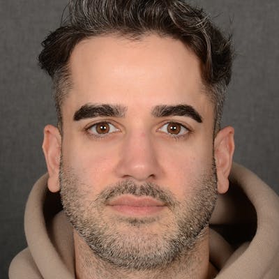 Male Rhinoplasty Before & After Gallery - Patient 216236 - Image 2