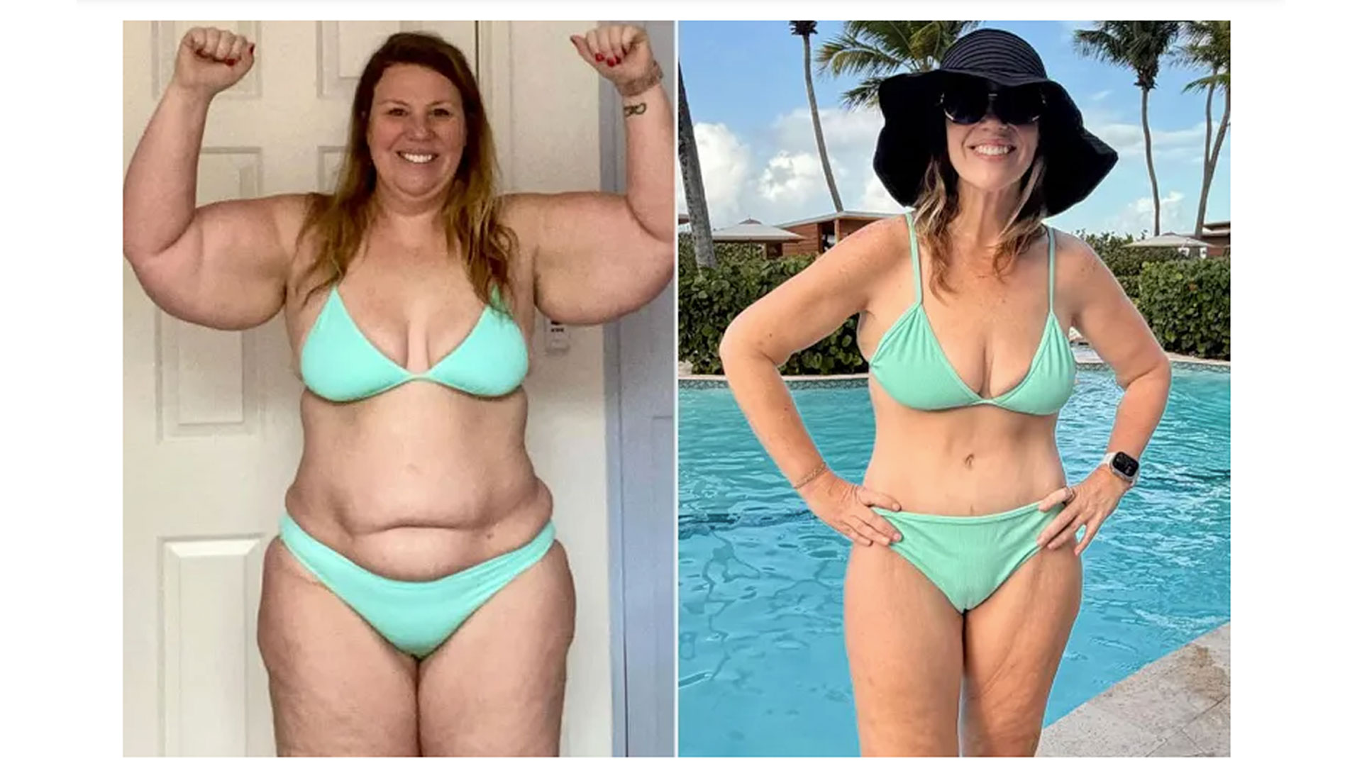 glp-1 butt Ozempic Explained: How To Avoid It She Lost 145 Pounds on