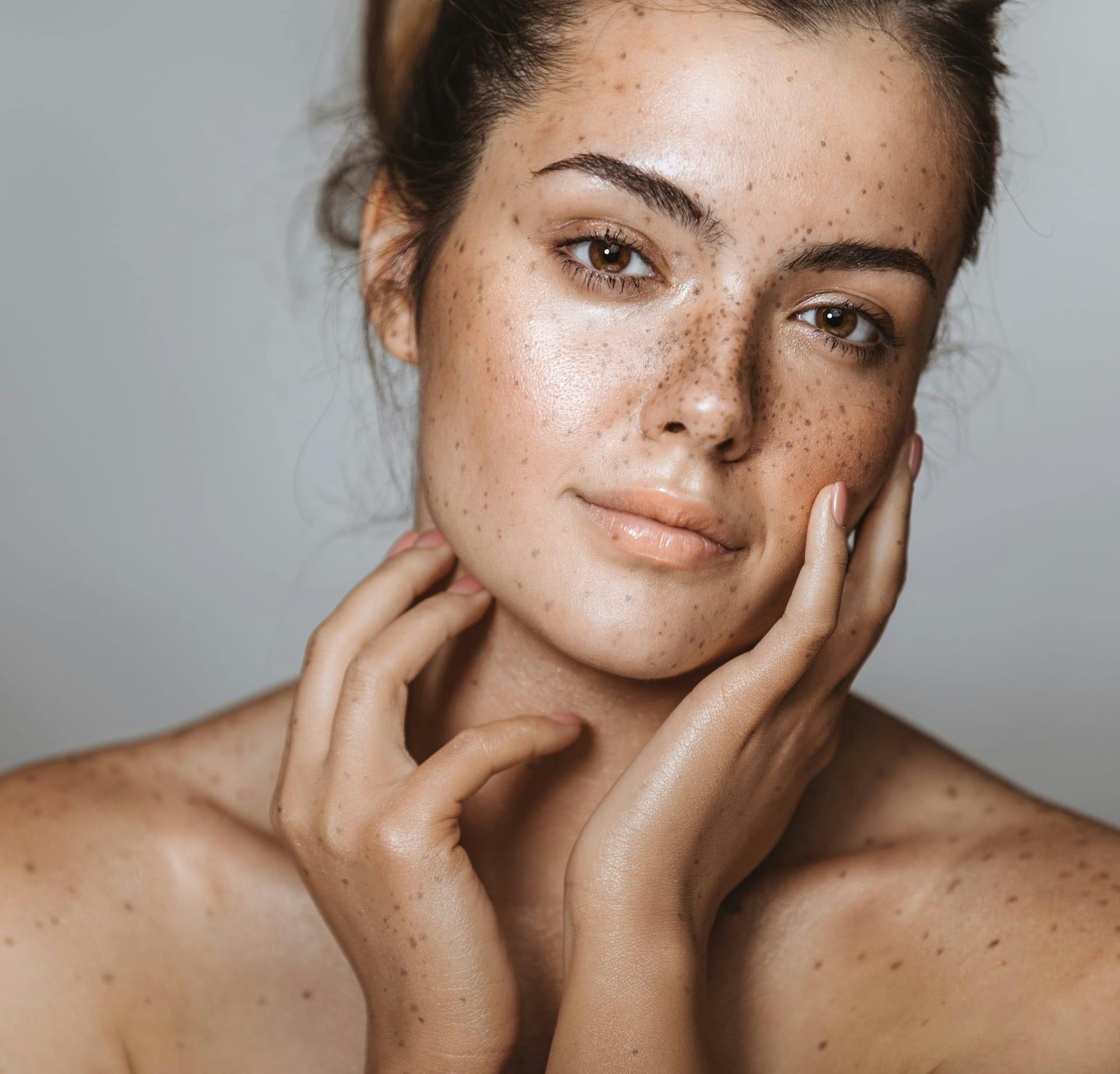 freckled woman holding face