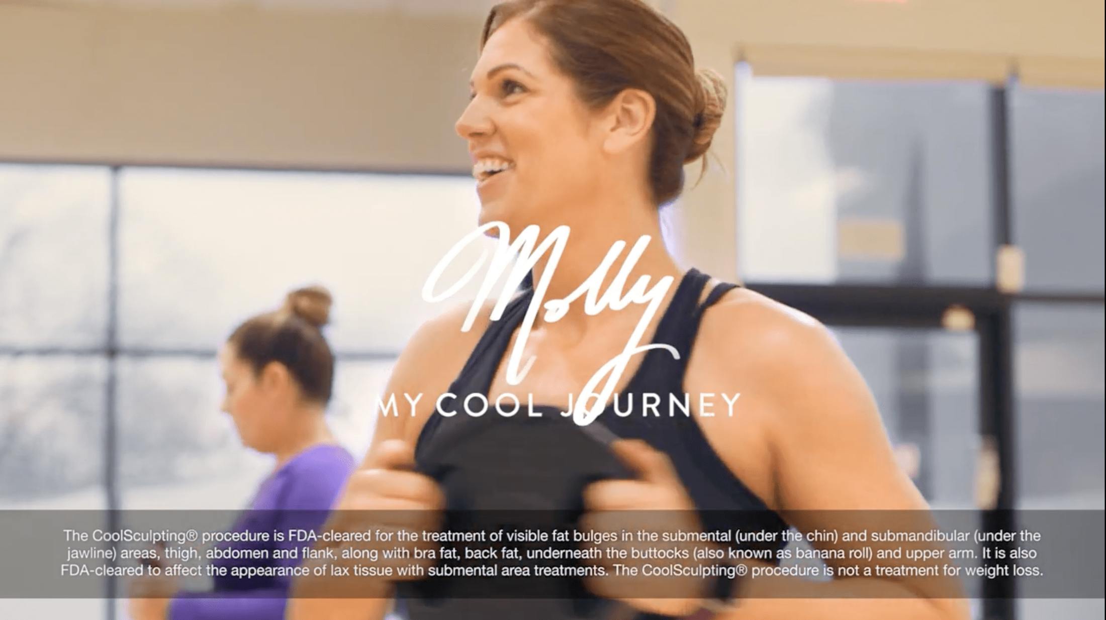 CoolSculpting patient testimonial video