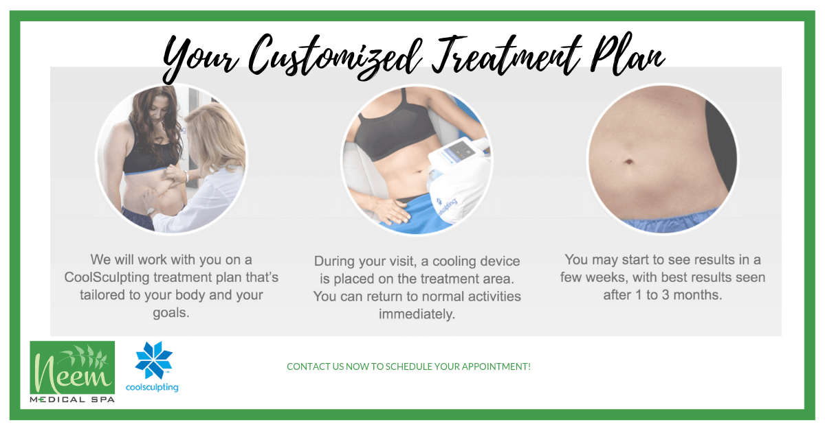 CoolSculpting infographic
