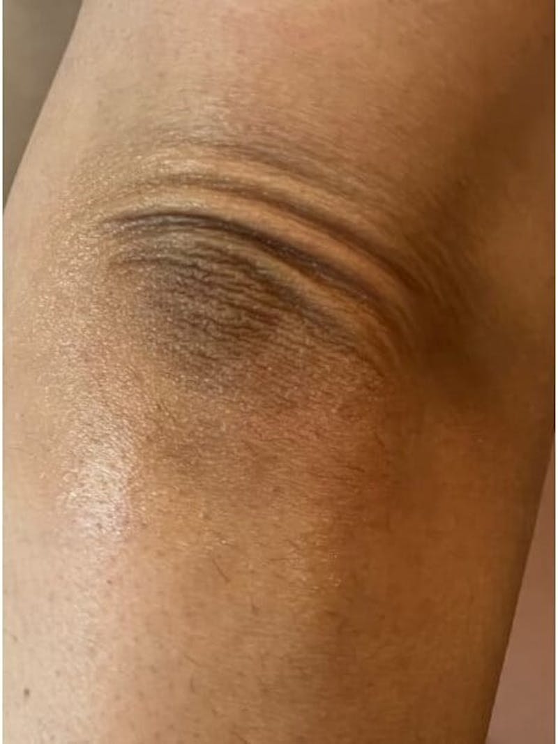 Skin Before & After Gallery - Patient 327589 - Image 1