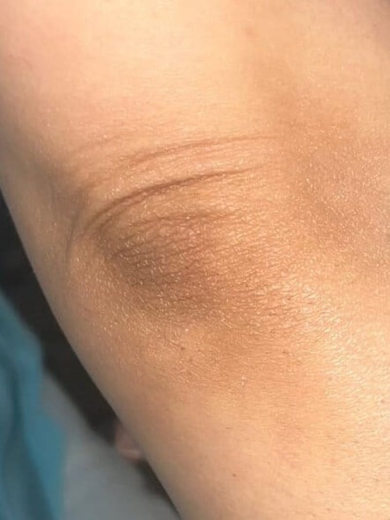 Skin Before & After Gallery - Patient 327589 - Image 2