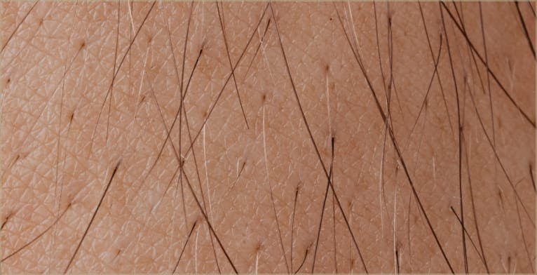 Hair reduction media