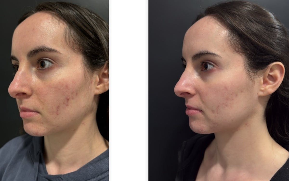 Face Before & After Gallery - Patient 401358 - Image 7