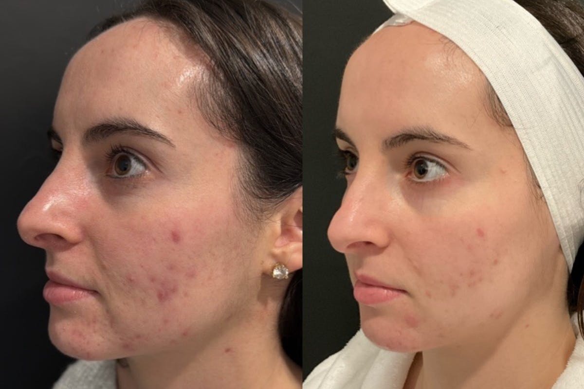 Face Before & After Gallery - Patient 401358 - Image 6