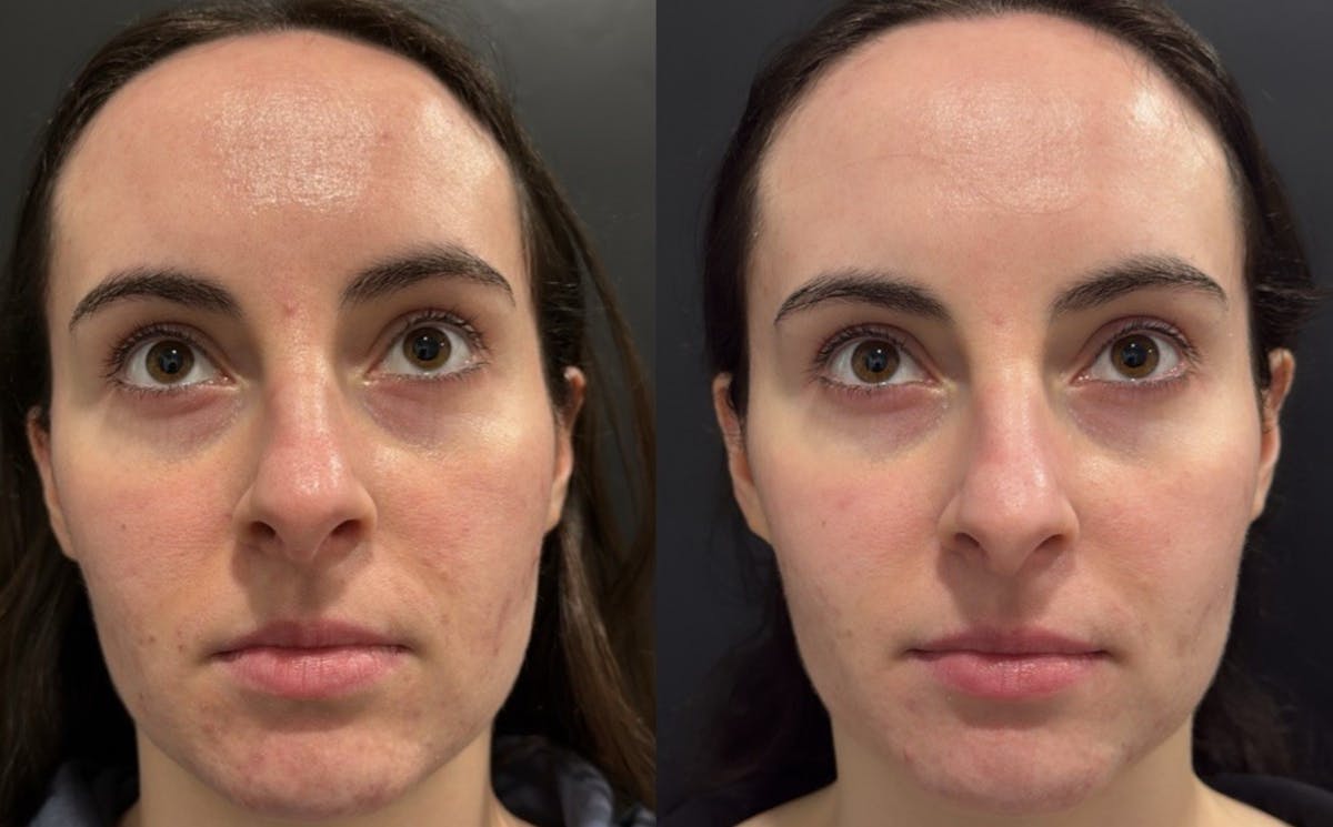 Face Before & After Gallery - Patient 401358 - Image 3