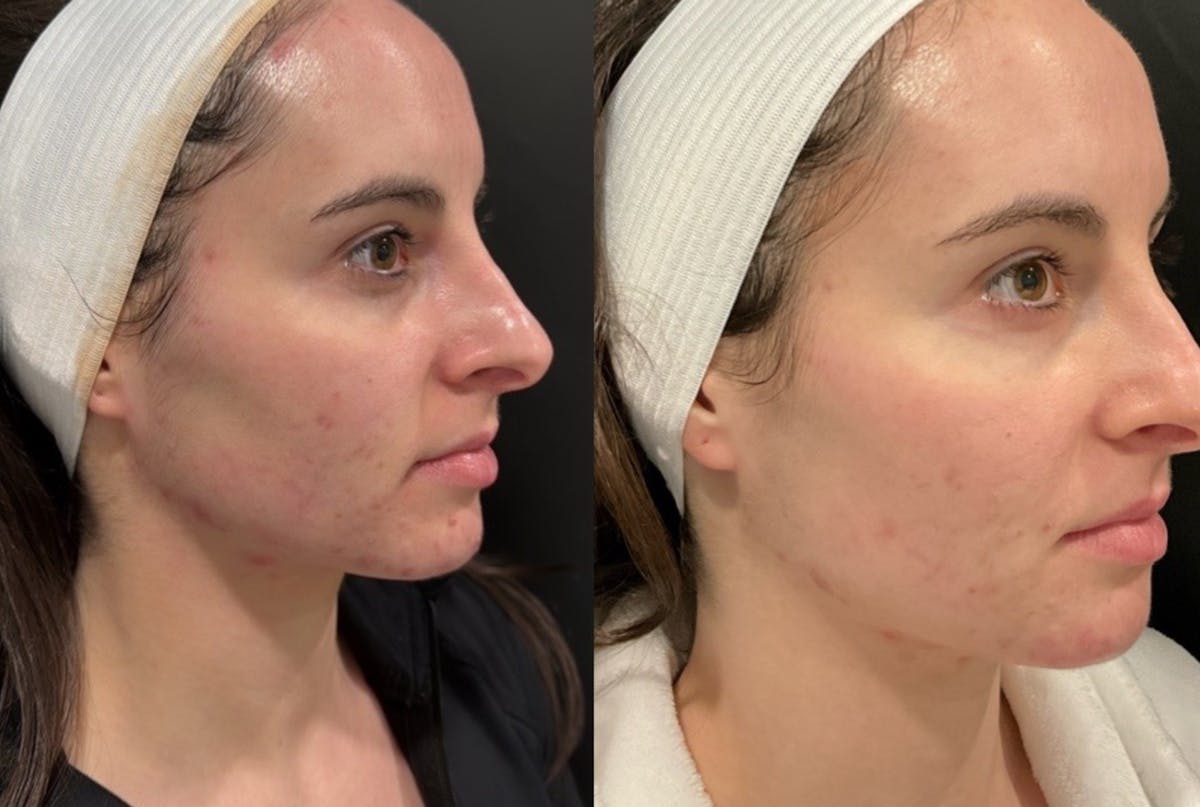 Face Before & After Gallery - Patient 401358 - Image 5