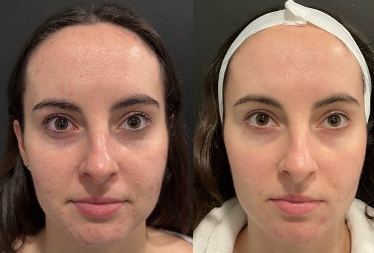Face Before & After Gallery - Patient 401358 - Image 2