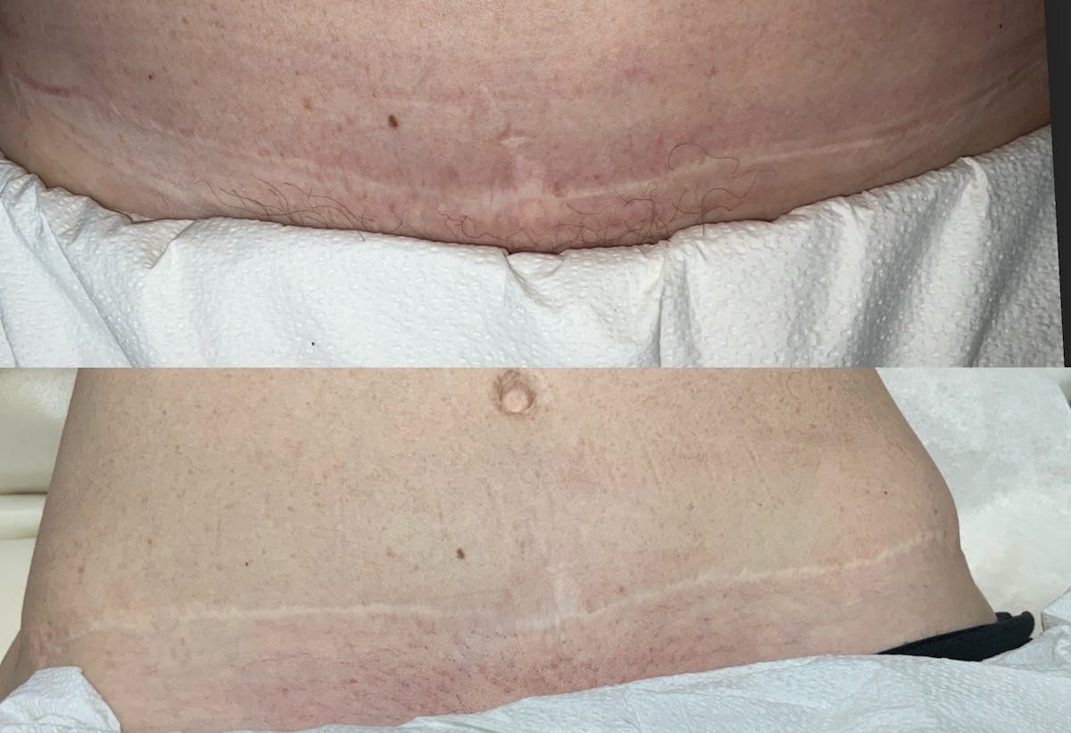 Skin Before & After Gallery - Patient 783482 - Image 1
