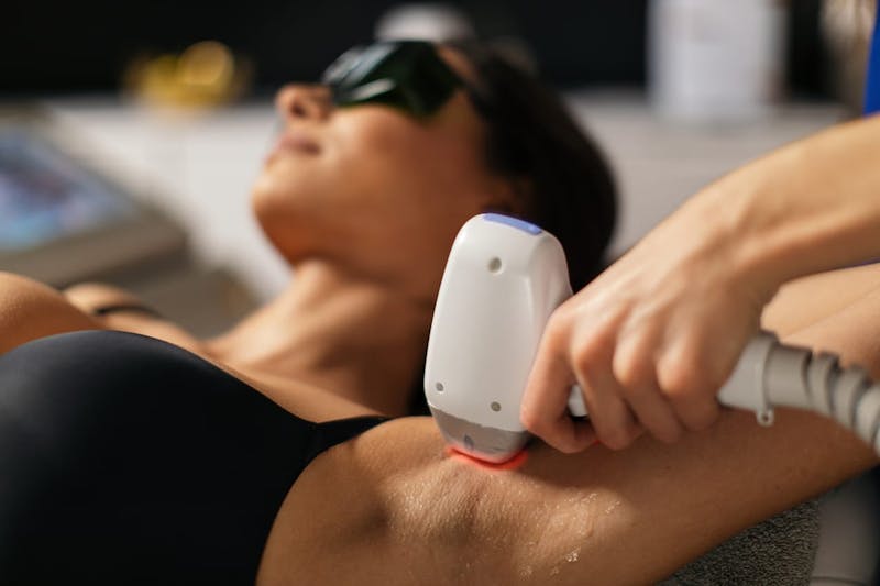 patient getting laser hair removal